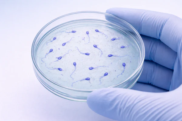 Sperm metrics β motility and morphology recovery