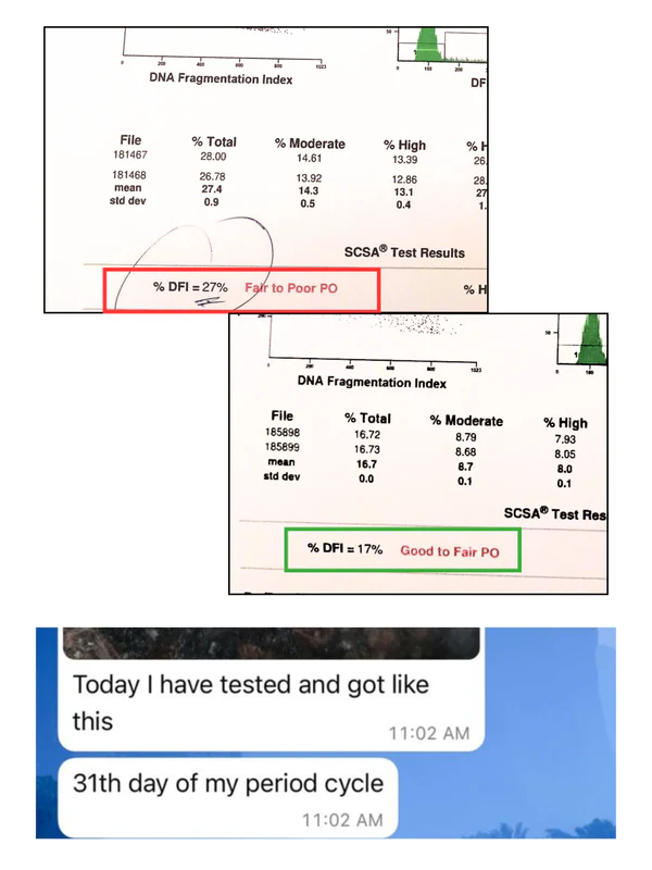 DFI reduction β 38% to 16% in 3 months
